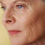 Ageing Skin Concerns