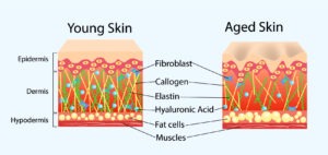 Skin Diagram Hyaluronic Acid