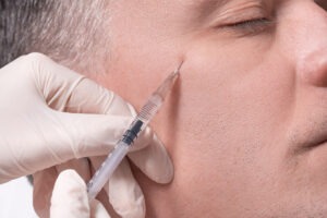 Crows Feet - anti-wrinkle injections